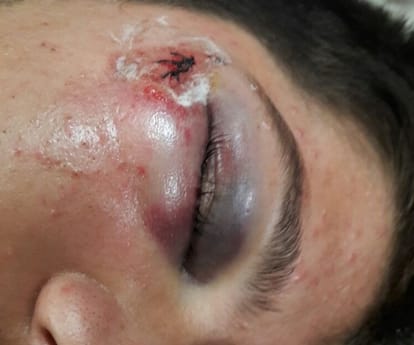  A student get beaten by his friends.