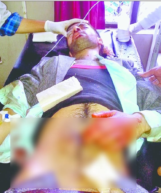 2 killed in accident in dodaa
