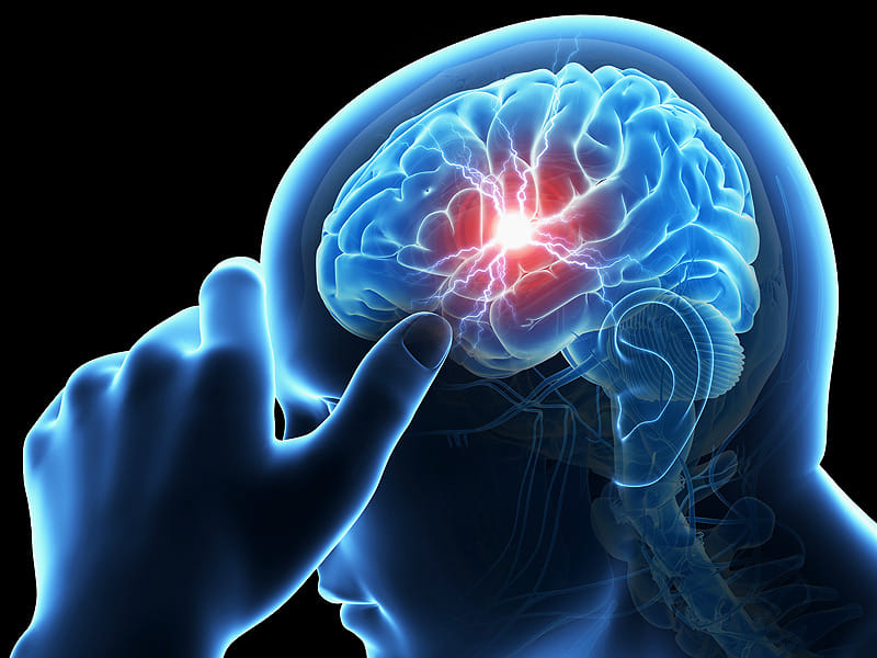 world stroke day 2023 causes and symptoms of stroke and its prevention