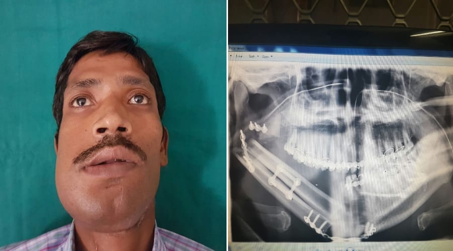 achievement of plastic surgery department doctors in kgmu