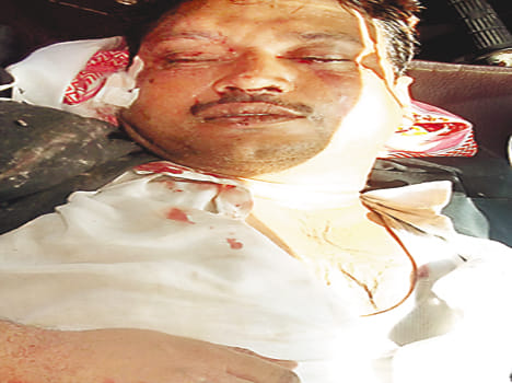 Deadly attack on lawyer