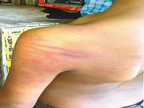 Do not count on the teacher student beaten to hear