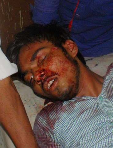 bikers accident by bus