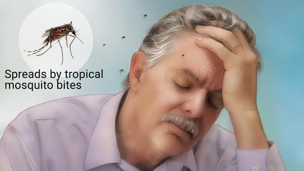 Dont be afraid to Dengue, here is some tips for avoid dengue