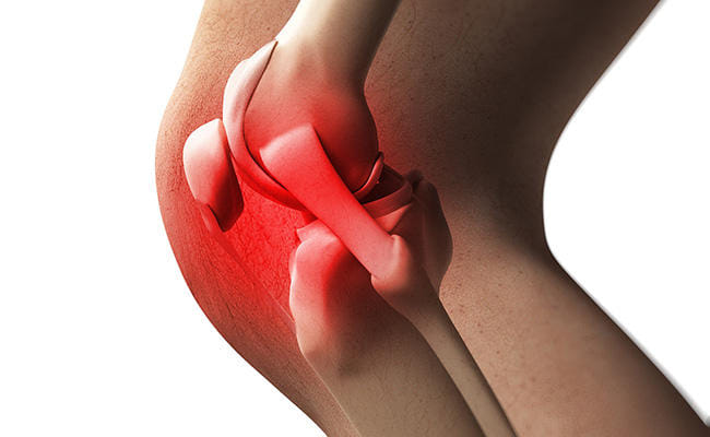 Nanoparticle jabs may help treat arthritis: Study