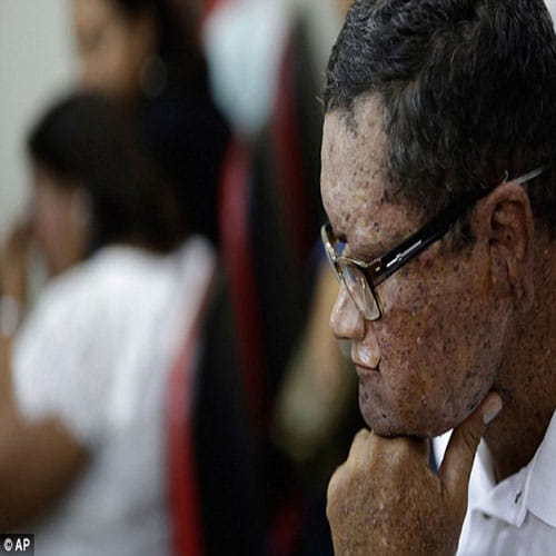 Skin Disease Makes Citizens Melt