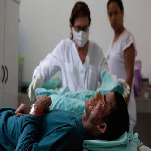 Skin Disease Makes Citizens Melt