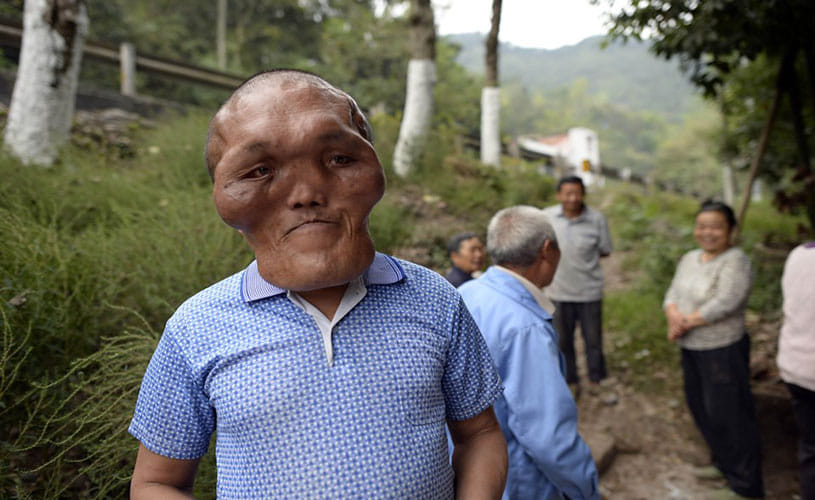 THE MAN WITH AN 'ALIEN FACE'