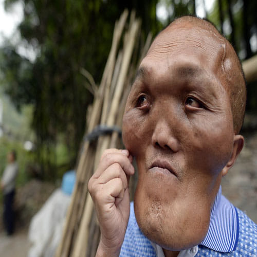 THE MAN WITH AN 'ALIEN FACE'