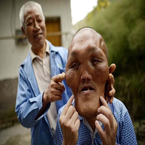 THE MAN WITH AN 'ALIEN FACE'