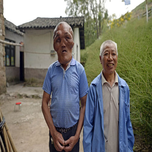 THE MAN WITH AN 'ALIEN FACE'