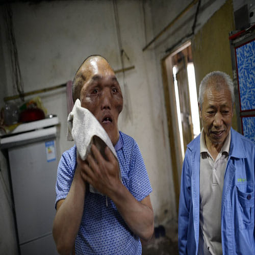 THE MAN WITH AN 'ALIEN FACE'