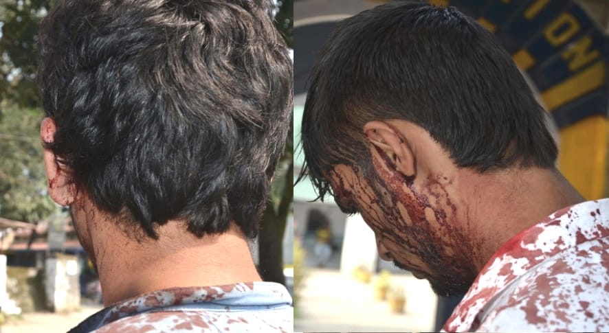 Riot at Hamirpur College, Clash between SFI and ABVP.