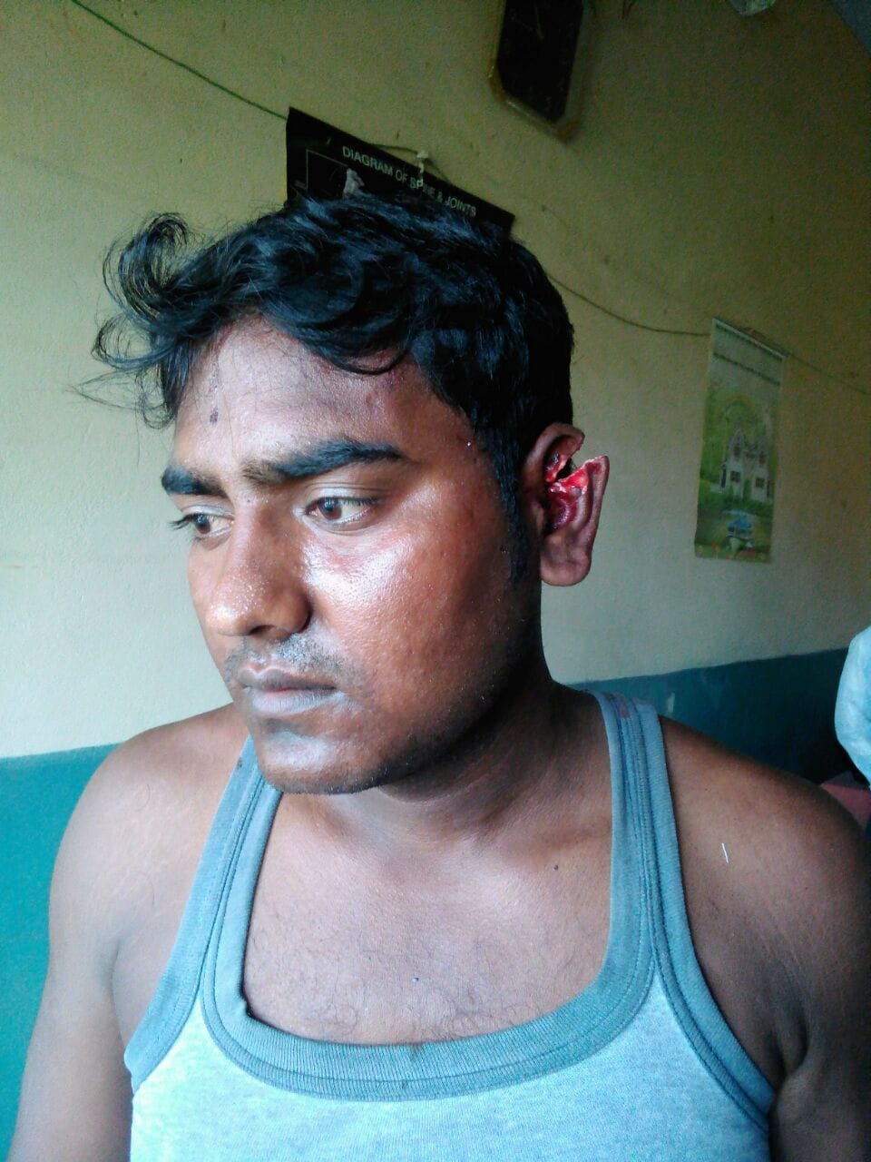 sadhu cut ear of a youth