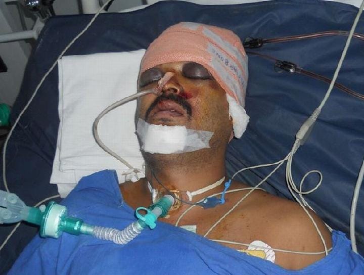Policemen injured in accident