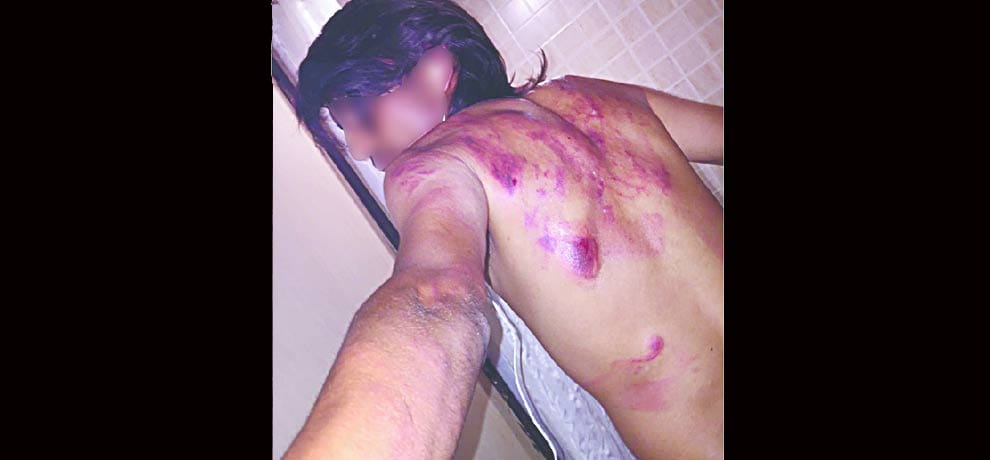 three arrest in inhumane ragging case in greater noida