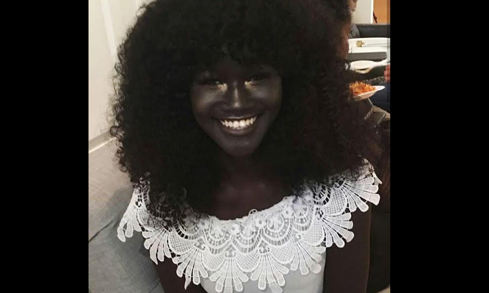 darkest skin tone model in africa