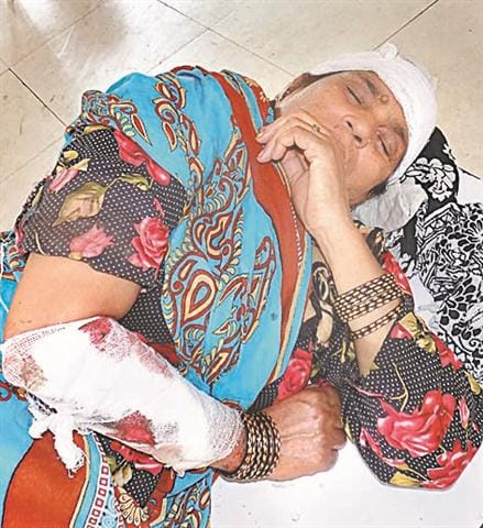 Save dumper upturned bus, 20 passengers injured
