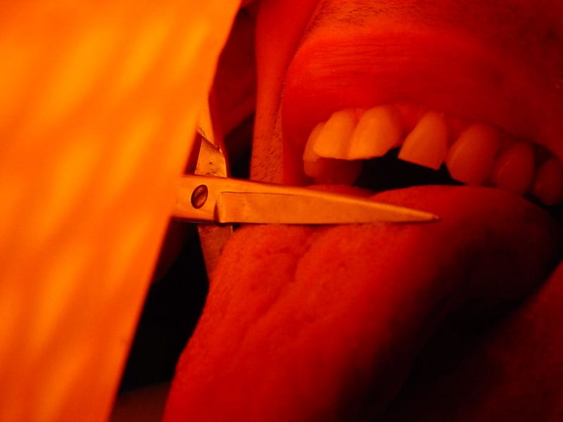 MP: woman cut her tongue