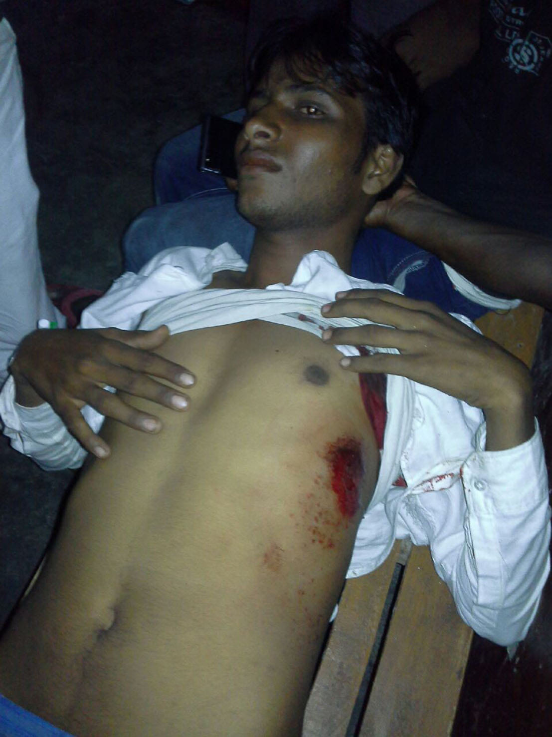 two persons shooted, injured