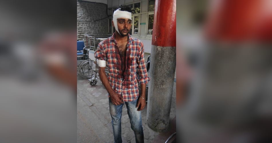Punjab university fight, pu fight, minor fights, badly injured