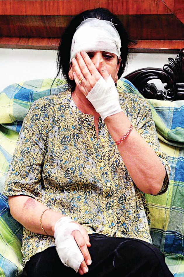 Woman robbed of three hundred, dragged on the road
