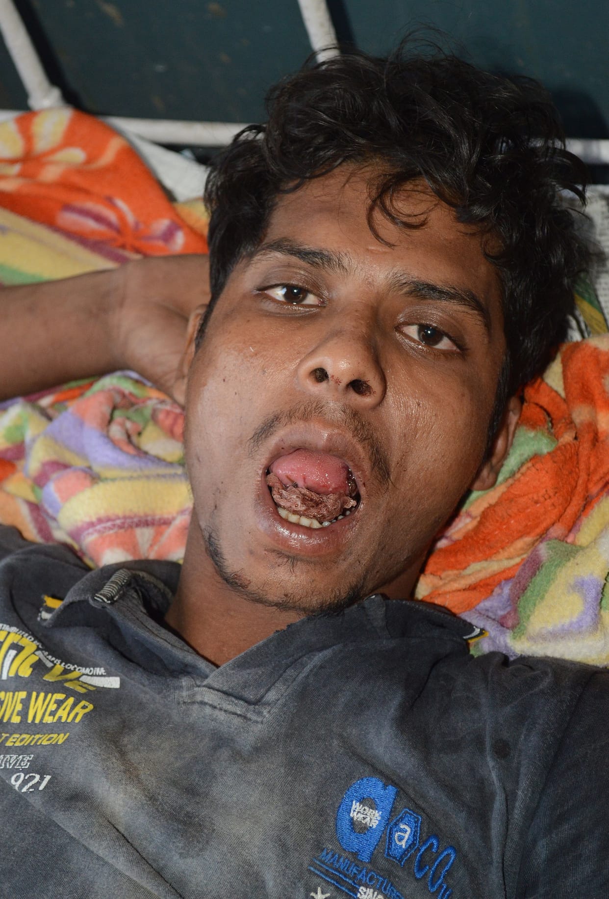 wife cut husband's tongue 