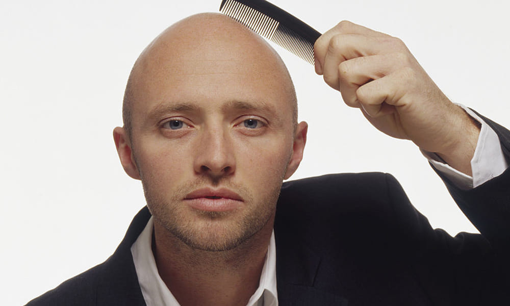 Ayurvedic Method To Get Rid Of Baldness