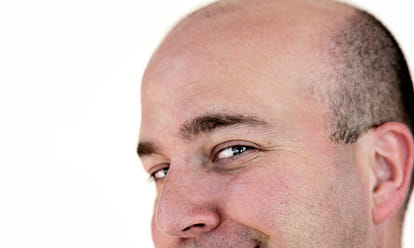 baldness is good for some