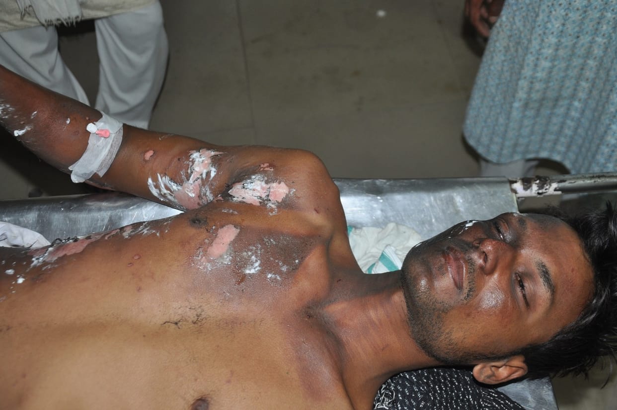 Six people burn by electric current