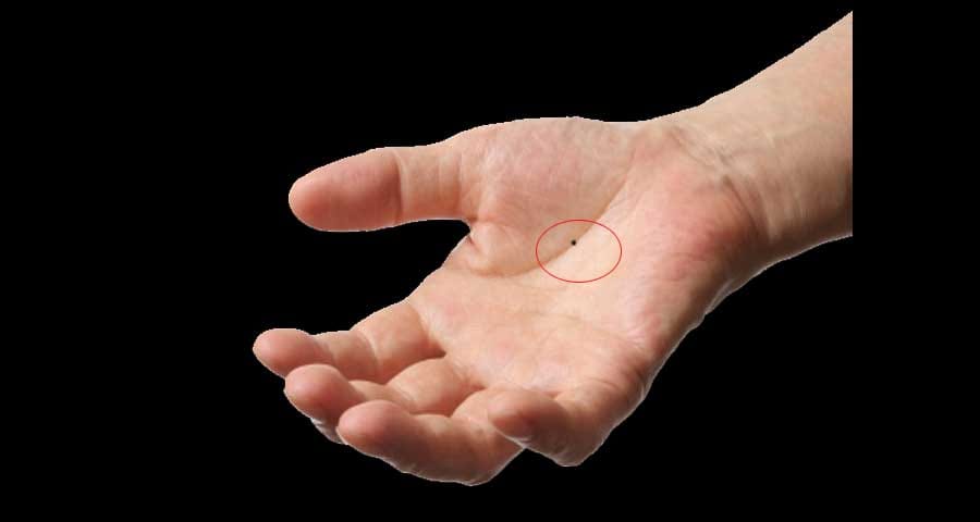 palmistry sign of future diseases and accidents