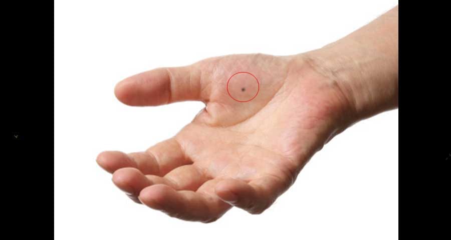 palmistry mole on hand meaning