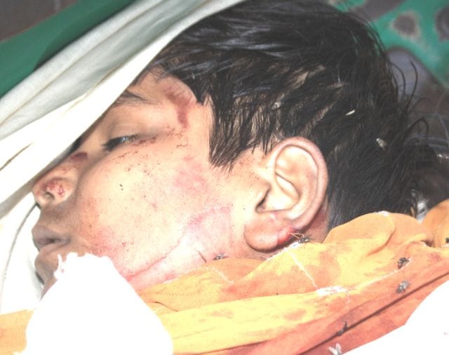 Truck thrashed two students, one killed