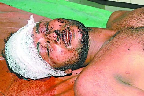 FOP transactions of Rs 90 to hit the flea, serious