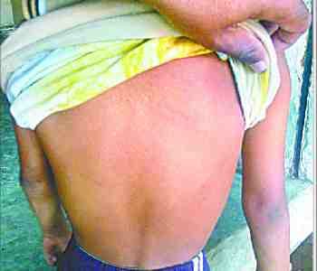 Principal student beaten with a stick
