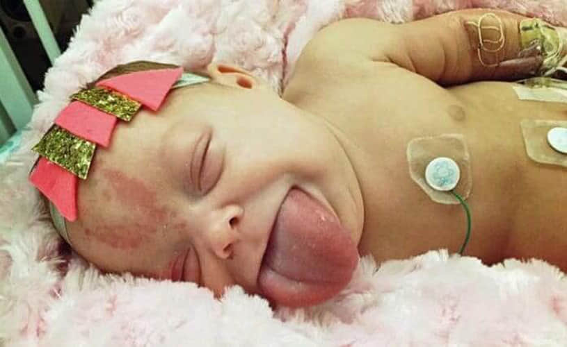 Baby girl born with her big TONGUE