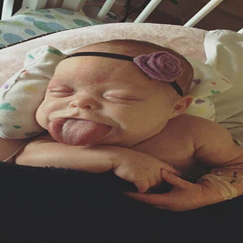Baby girl born with her big TONGUE
