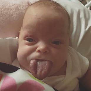 Baby girl born with her big TONGUE