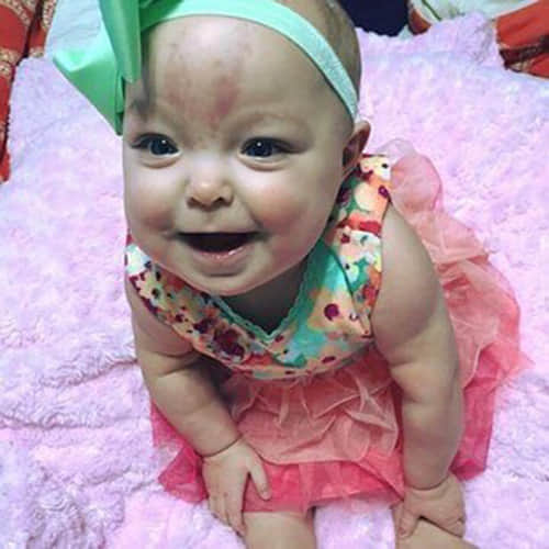 Baby girl born with her big TONGUE
