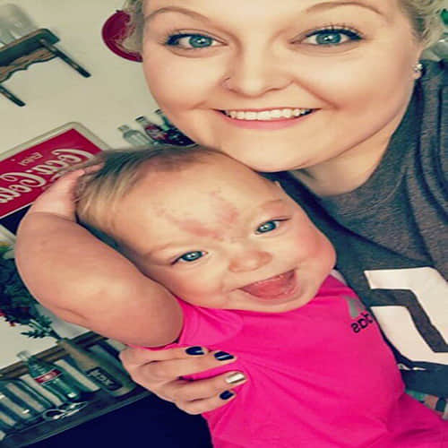 Baby girl born with her big TONGUE
