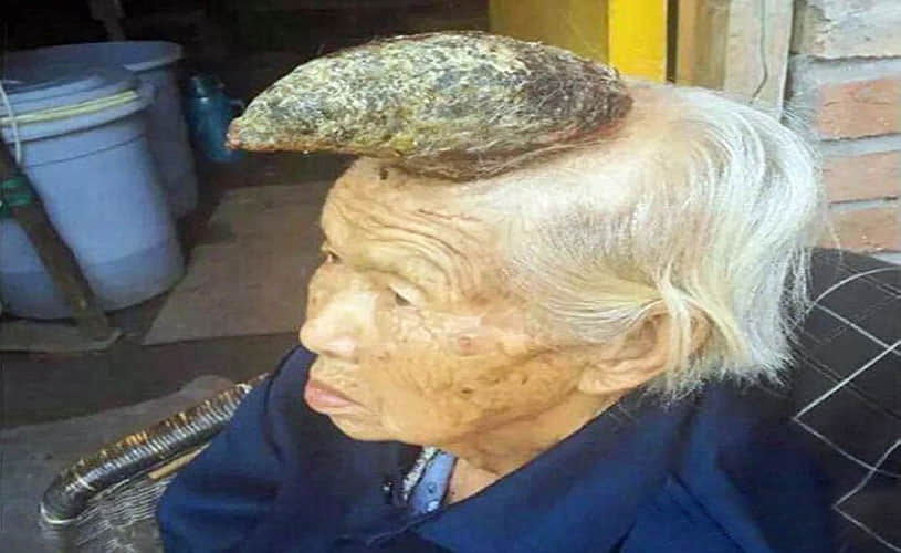  woman who has a HORN on her head