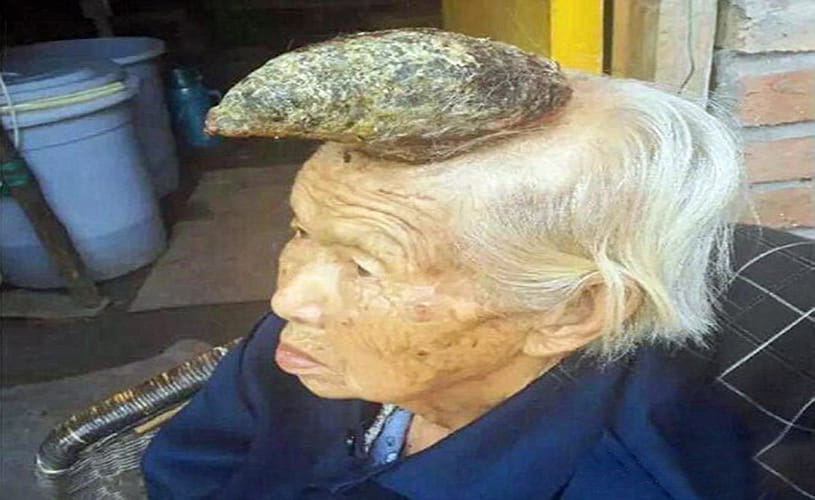  woman who has a HORN on her head