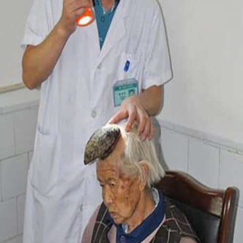  woman who has a HORN on her head