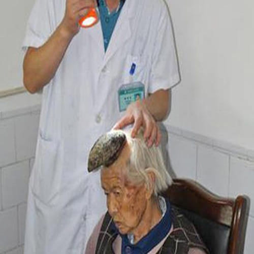  woman who has a HORN on her head