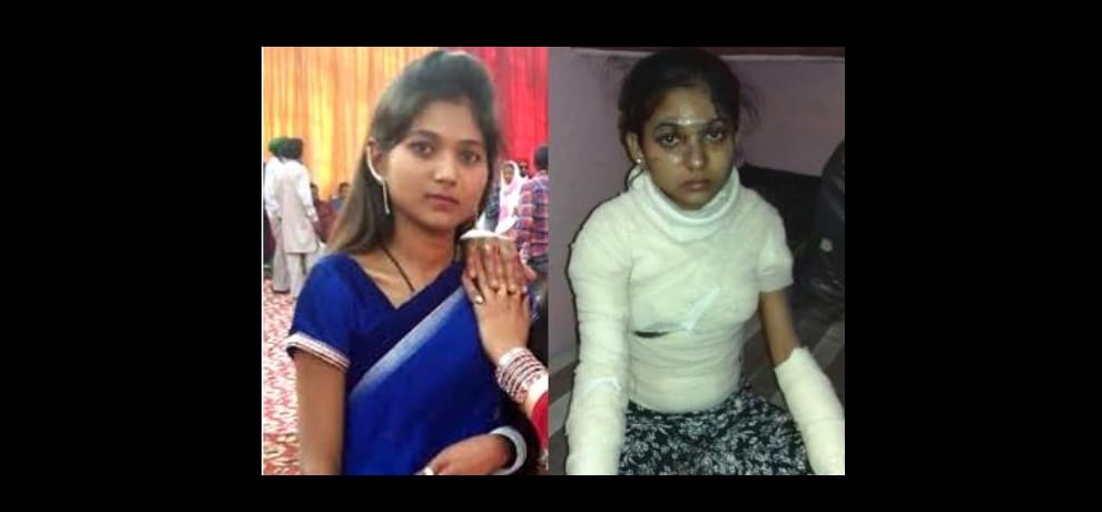 man throws acid on wife just before karwa chauth in delhi, 6 month they did love marriage