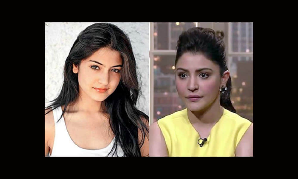 Plastic Surgery Disasters of Bollywood Celebrities