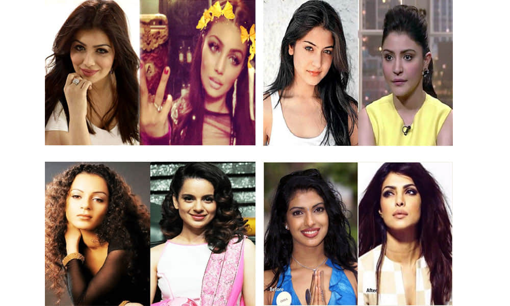 Plastic Surgery Disasters of Bollywood Celebrities