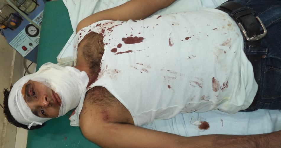 Murng bike skidded on, uncle killed, nephew wounded
