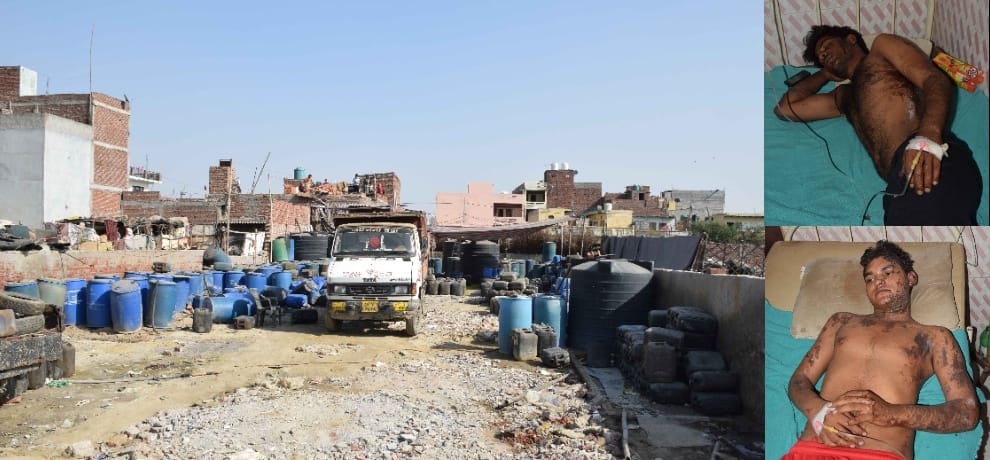 in a road rage canter driver throws acid on six including woman in noida's chotpur village