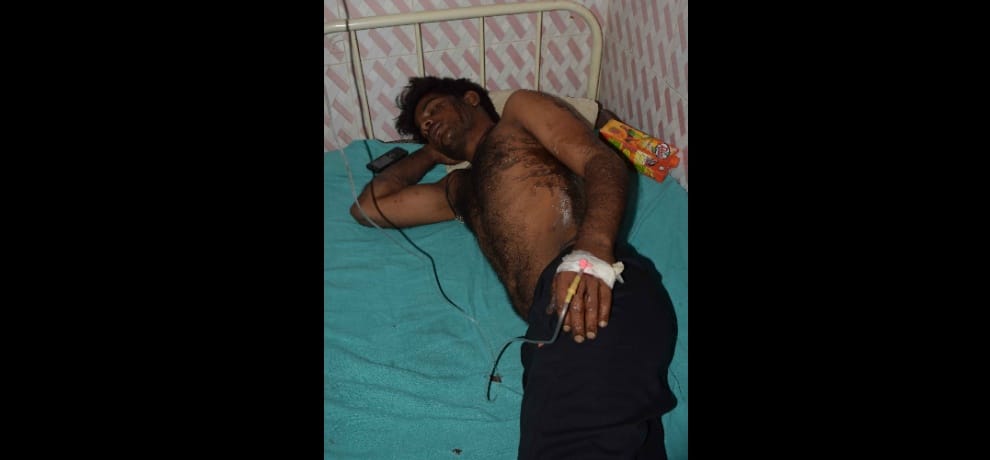 in a road rage canter driver throws acid on six including woman in noida's chotpur village